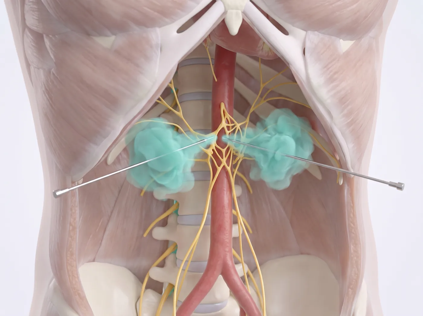 The block — medical illustration