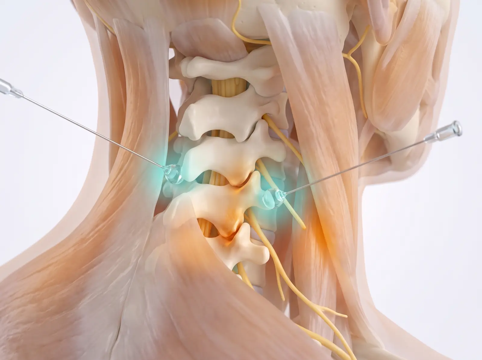 The test block — medical illustration