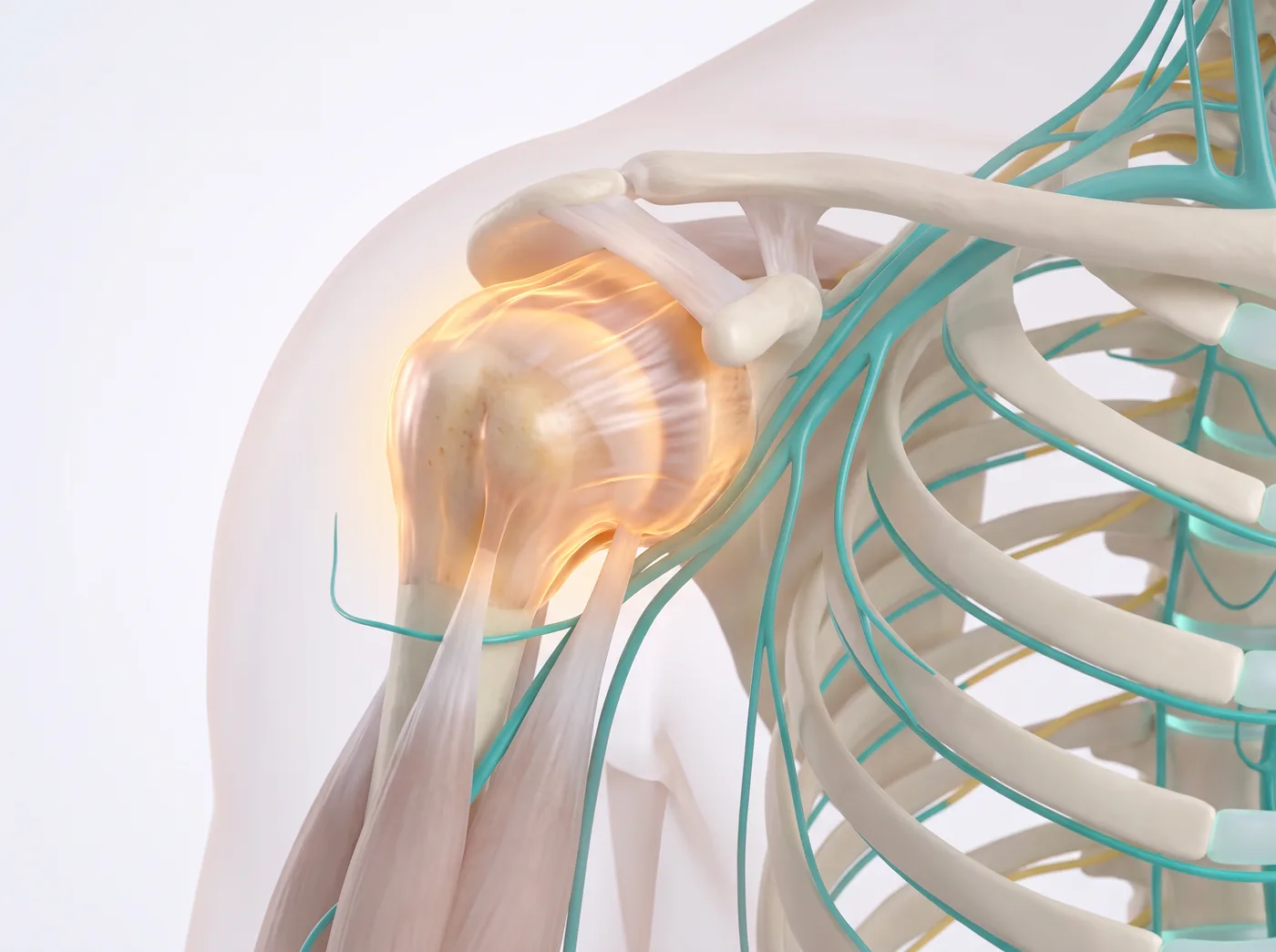 Frozen Shoulder (Adhesive Capsulitis) illustration