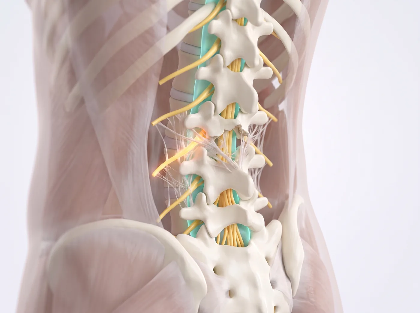 Persistent Pain After Back Surgery illustration