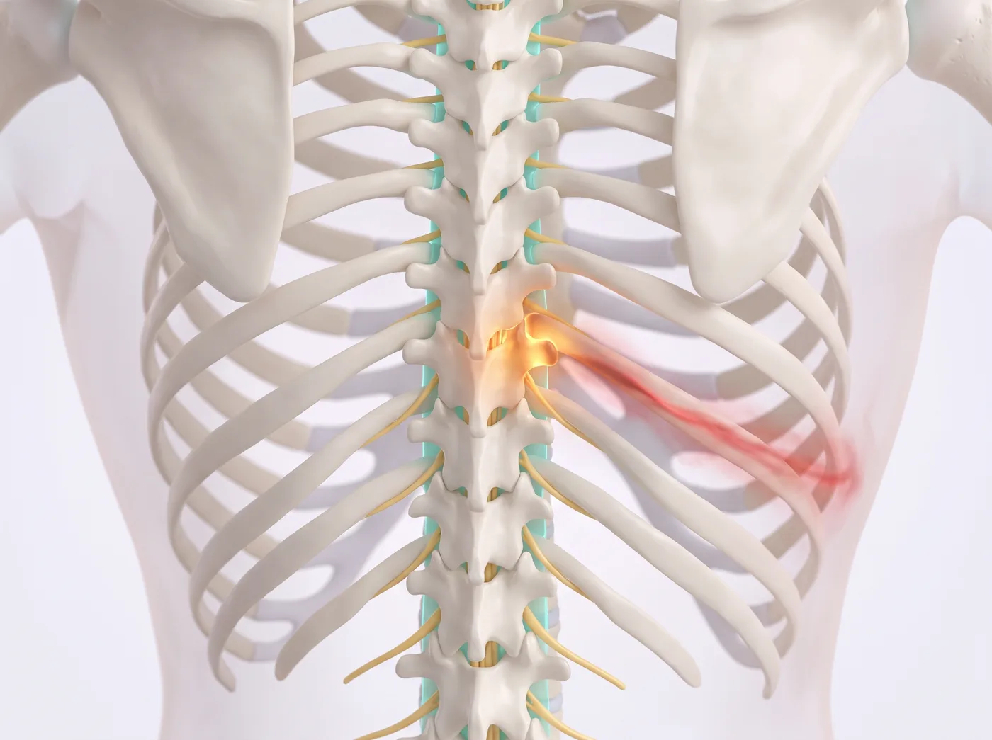Thoracic & Costovertebral Pain illustration