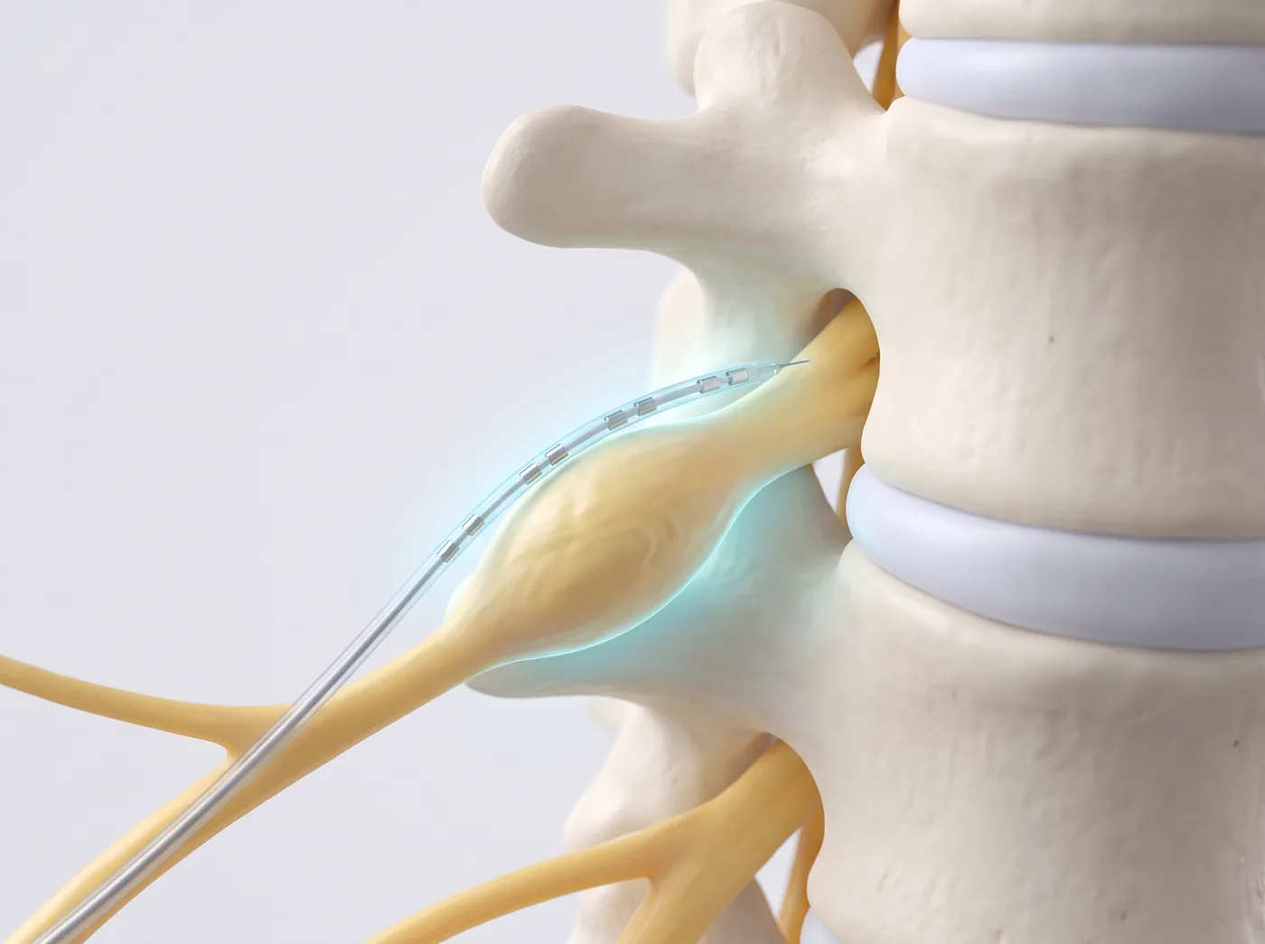 How it works — medical illustration