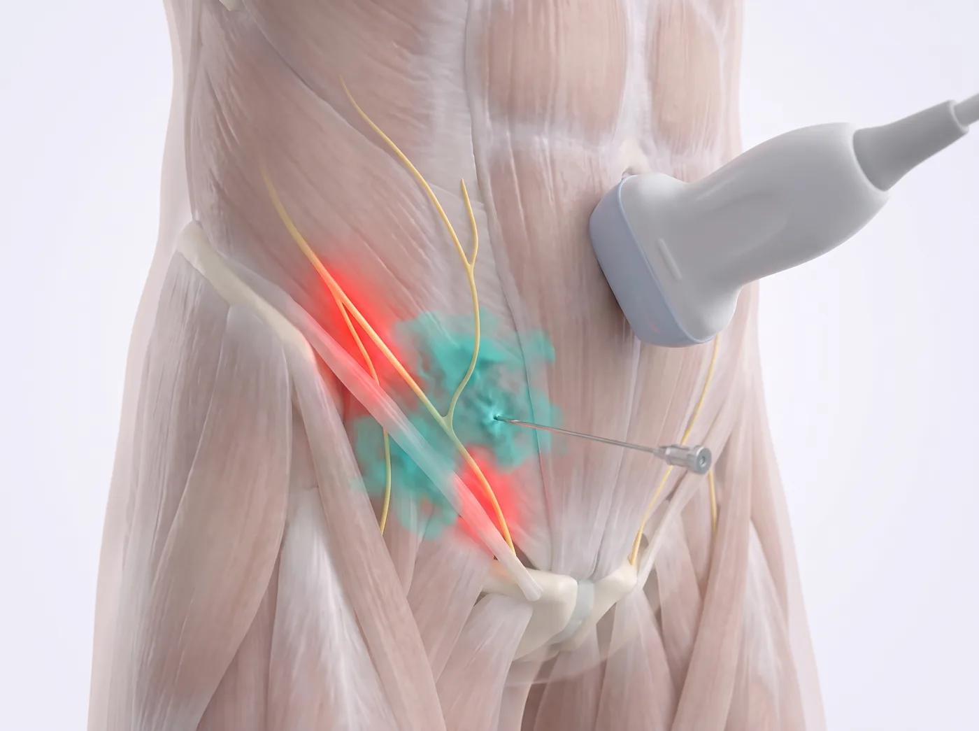 The plane — medical illustration