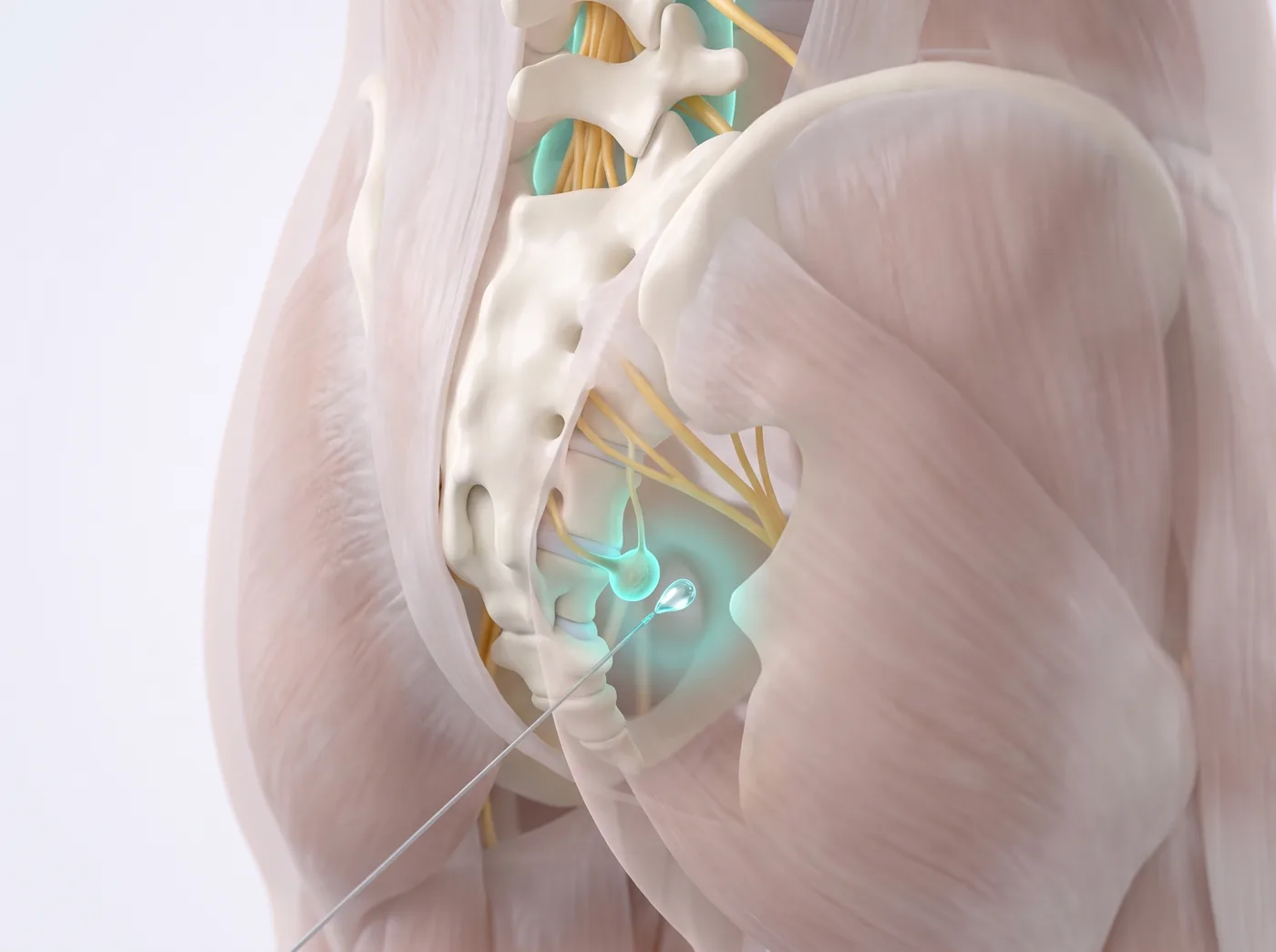 One small target — medical illustration