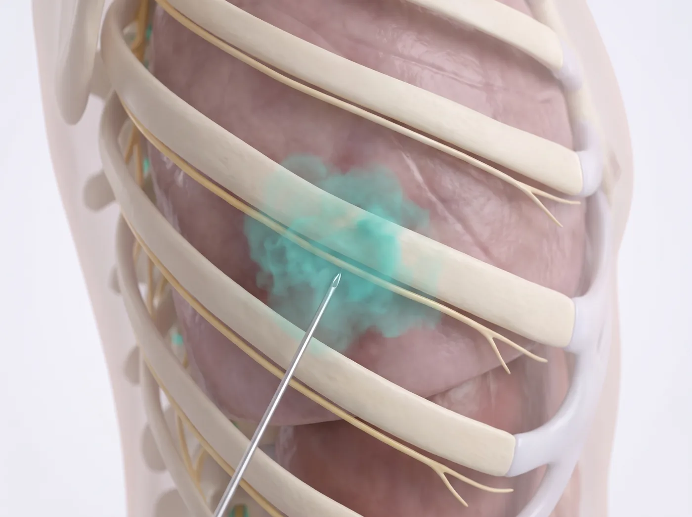 How it works — medical illustration