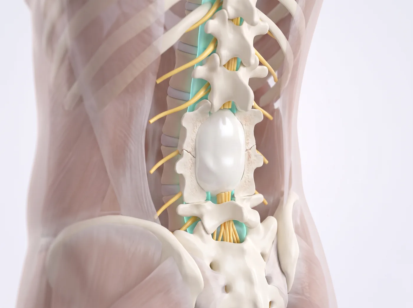 The cement — medical illustration
