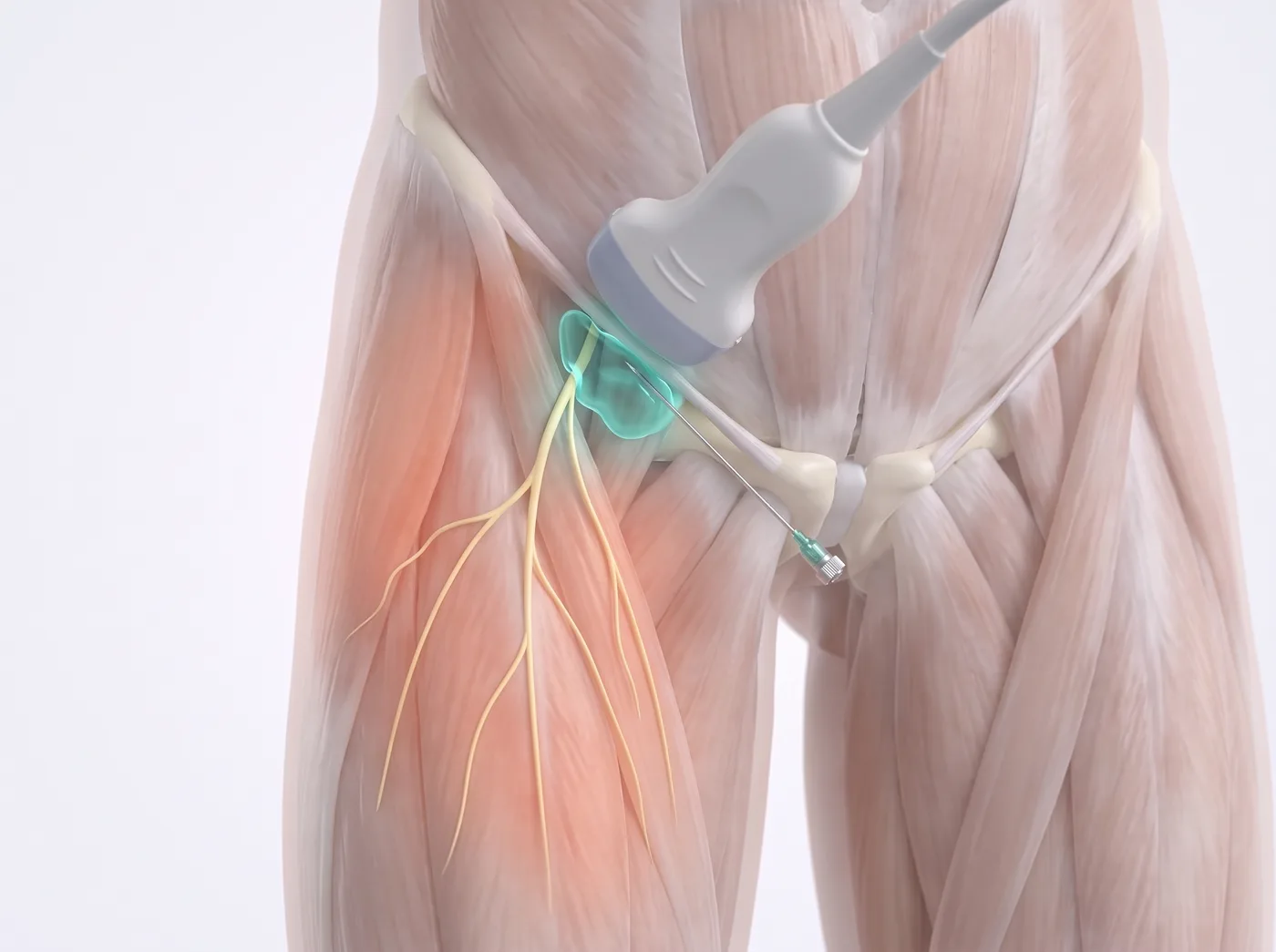 How it works — medical illustration