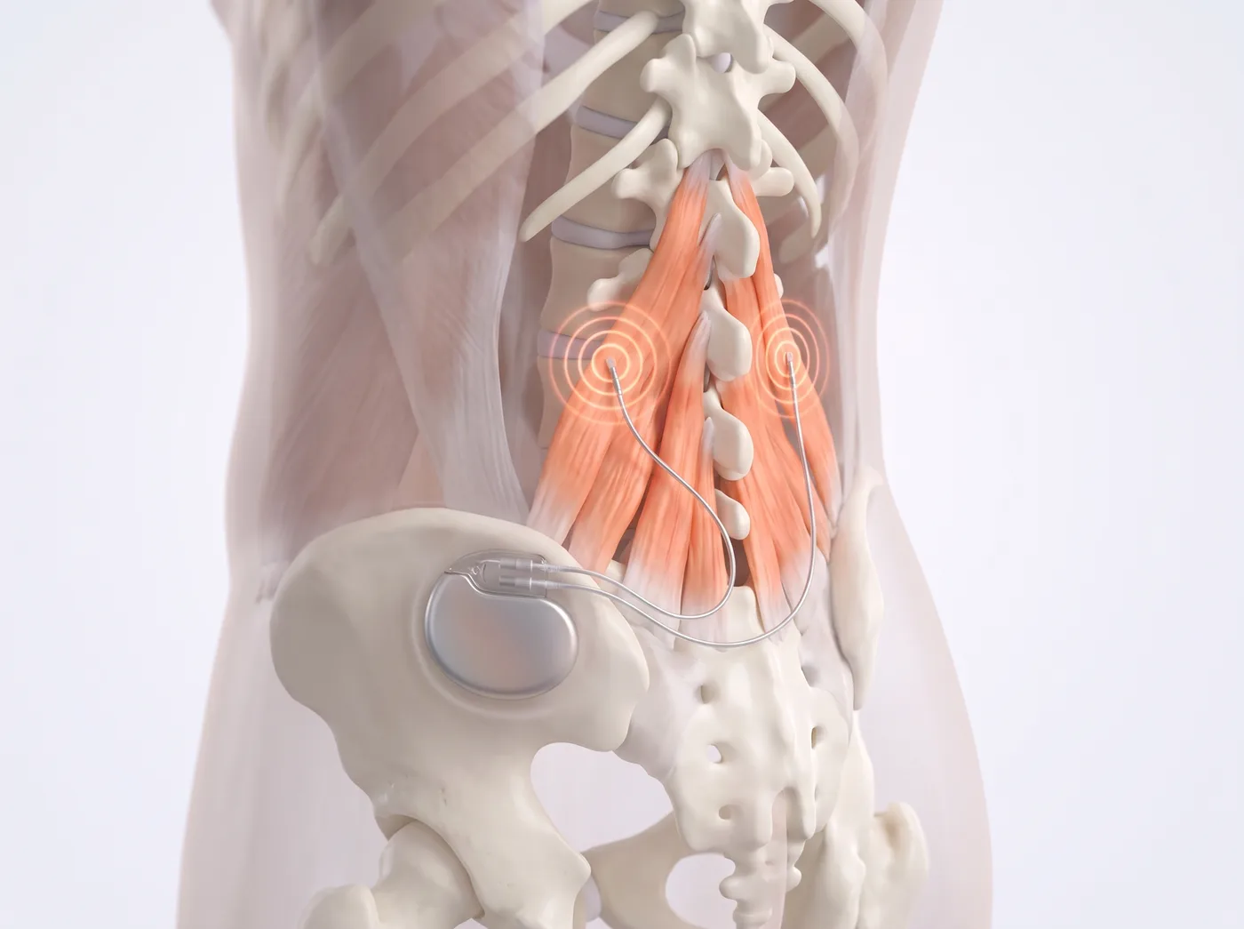 How it works — medical illustration