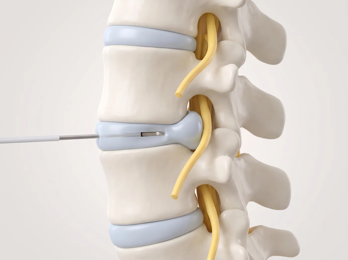 How it works — medical illustration
