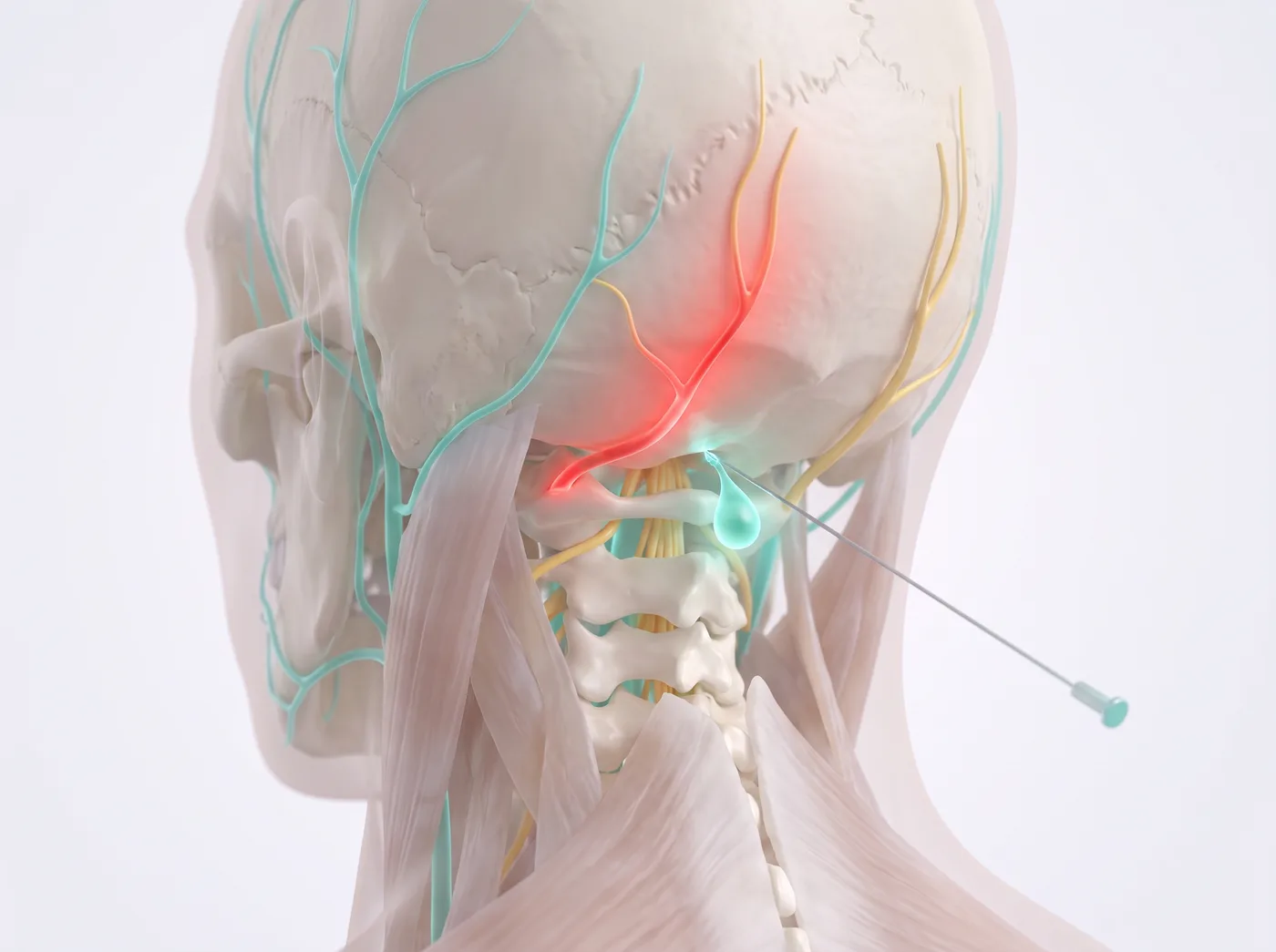 The block — medical illustration