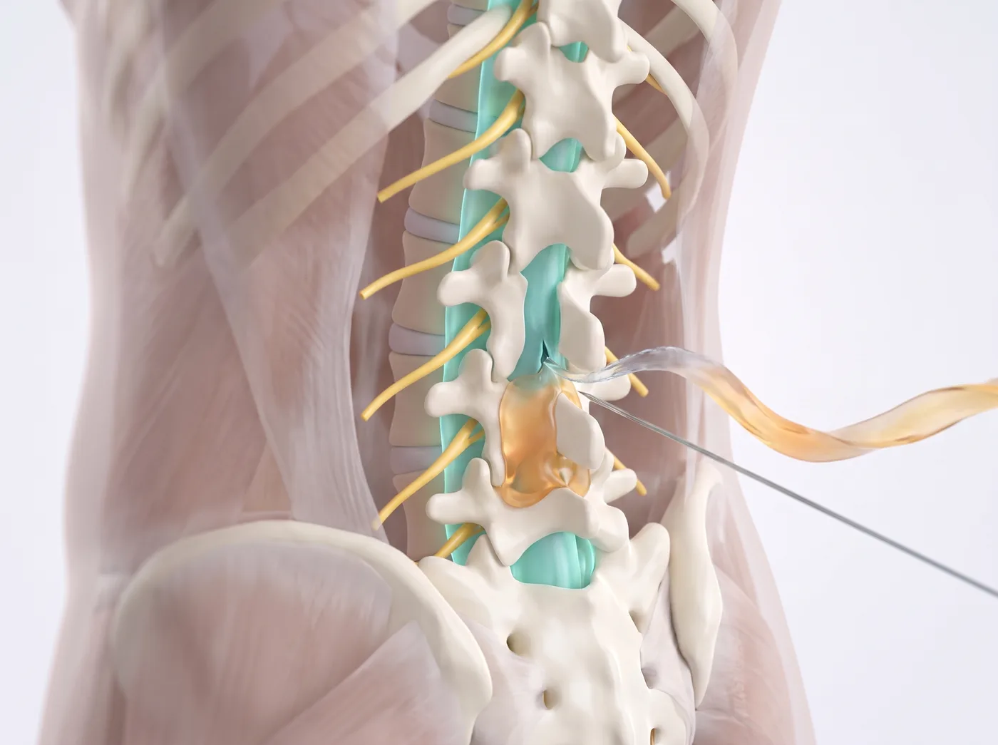 The seal — medical illustration