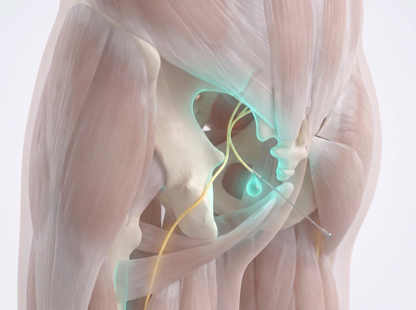 The block — medical illustration