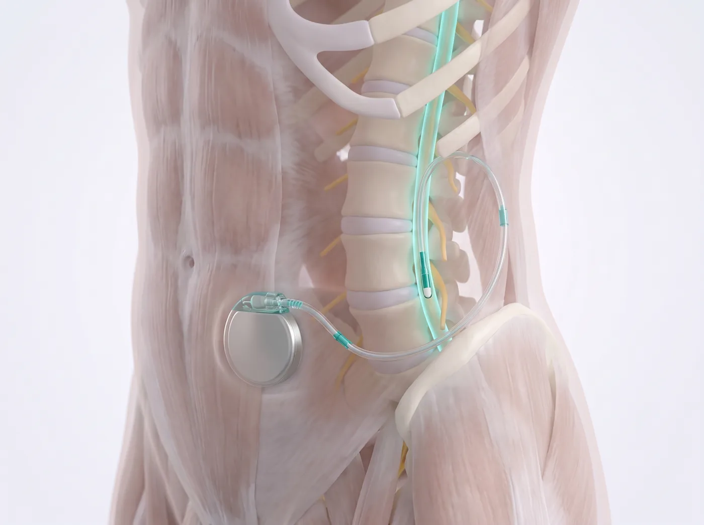 The system — medical illustration