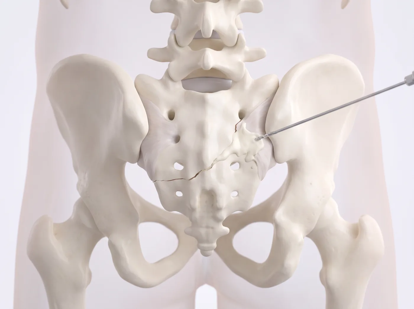 How it works — medical illustration