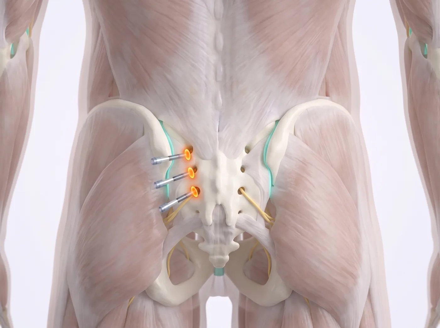 A row of quiet switches — medical illustration