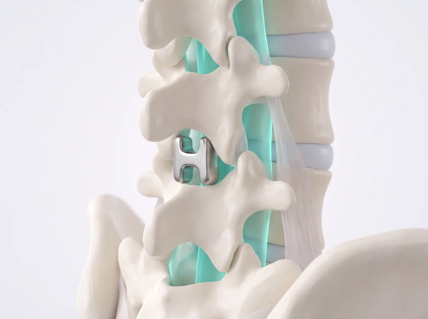 How it works — medical illustration