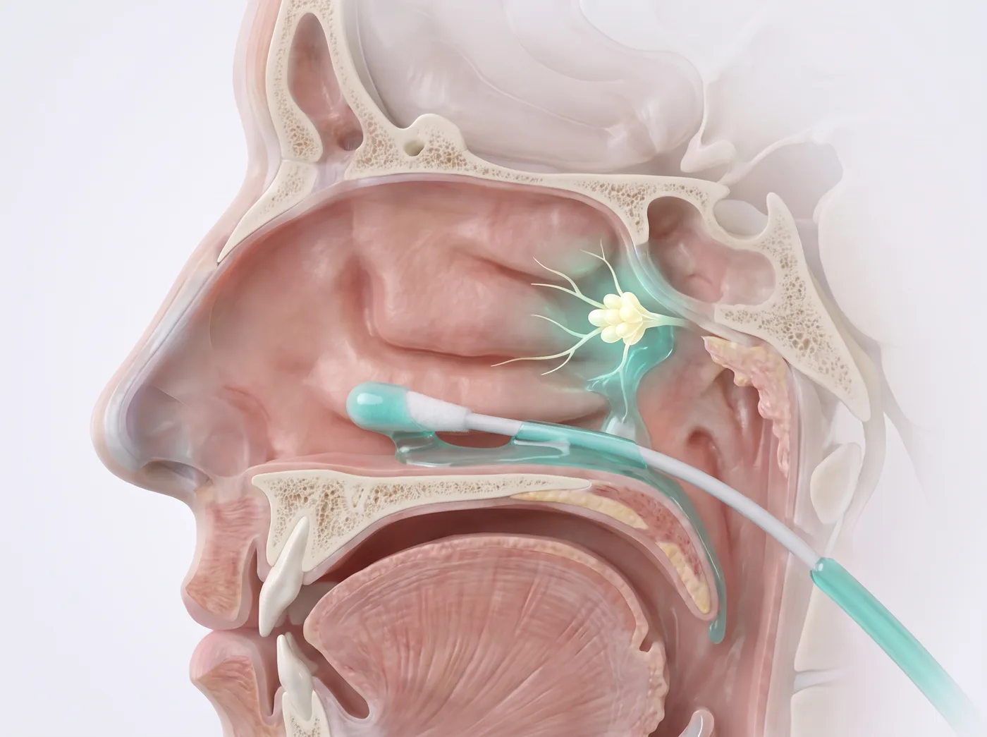 How it works — medical illustration