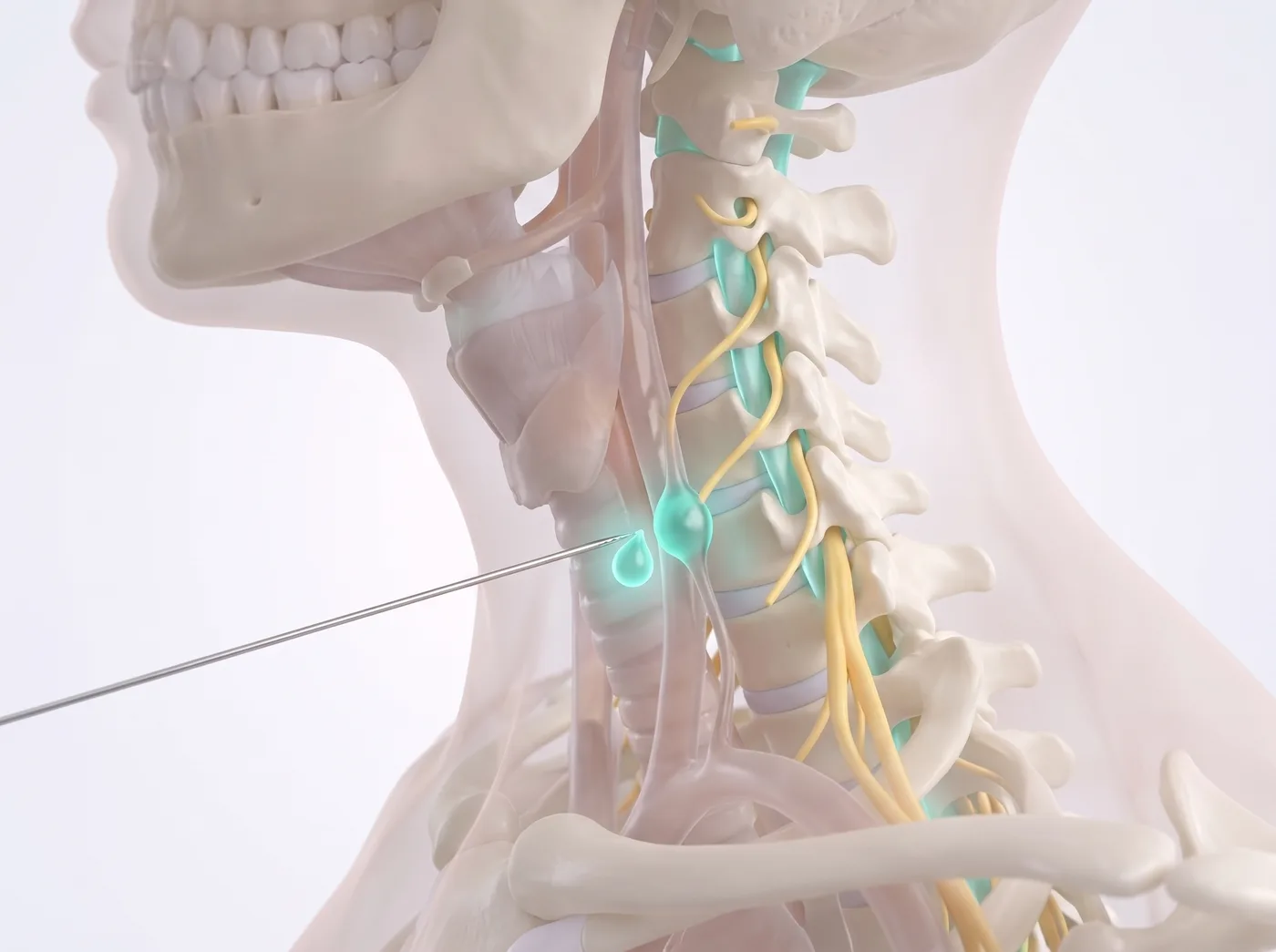The block — medical illustration