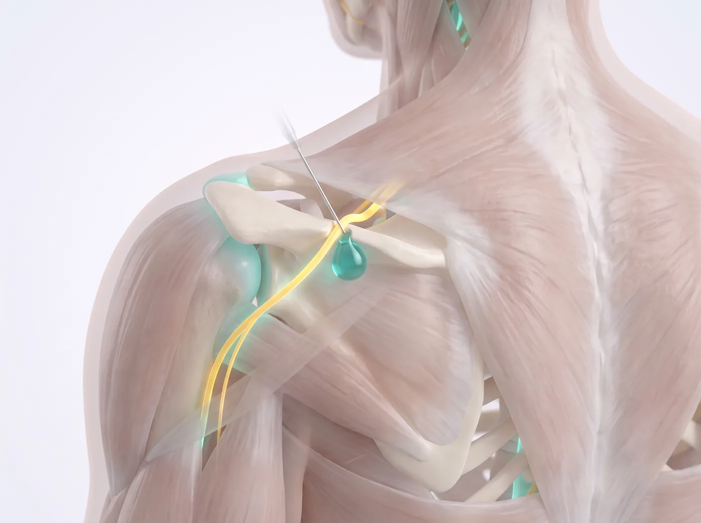 The block — medical illustration