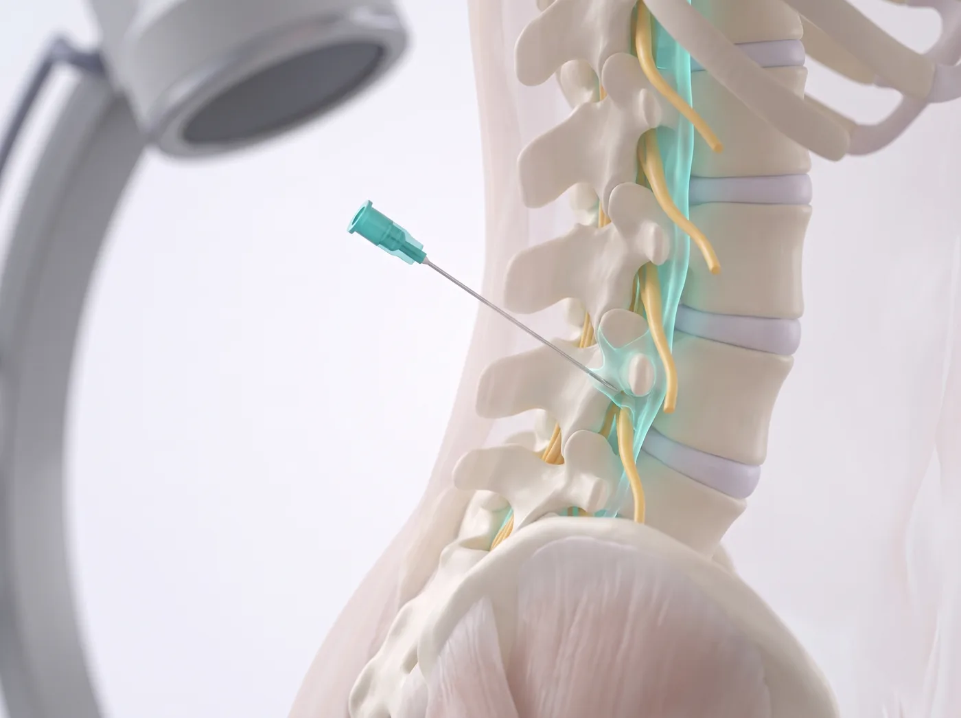 The procedure — medical illustration