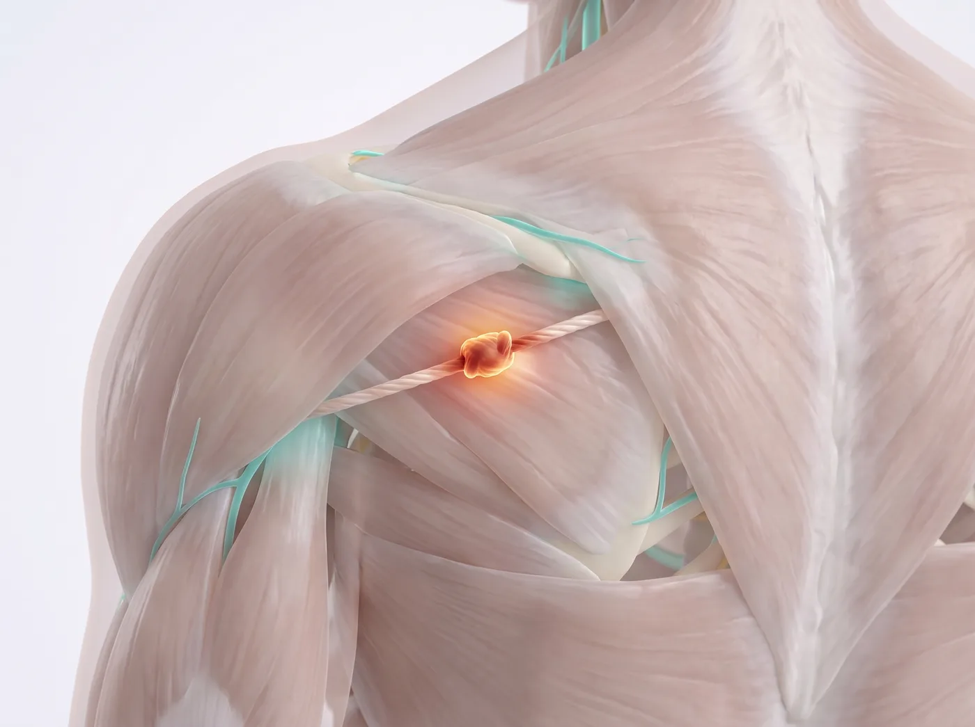 The knot — medical illustration